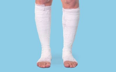 Supporting Surrounding Skin with Soothing Zinc Paste Bandages
